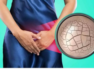 Nguyên nhân nào gây khô hạn ở phụ nữ trẻ tuổi? Làm sao để khắc phục?